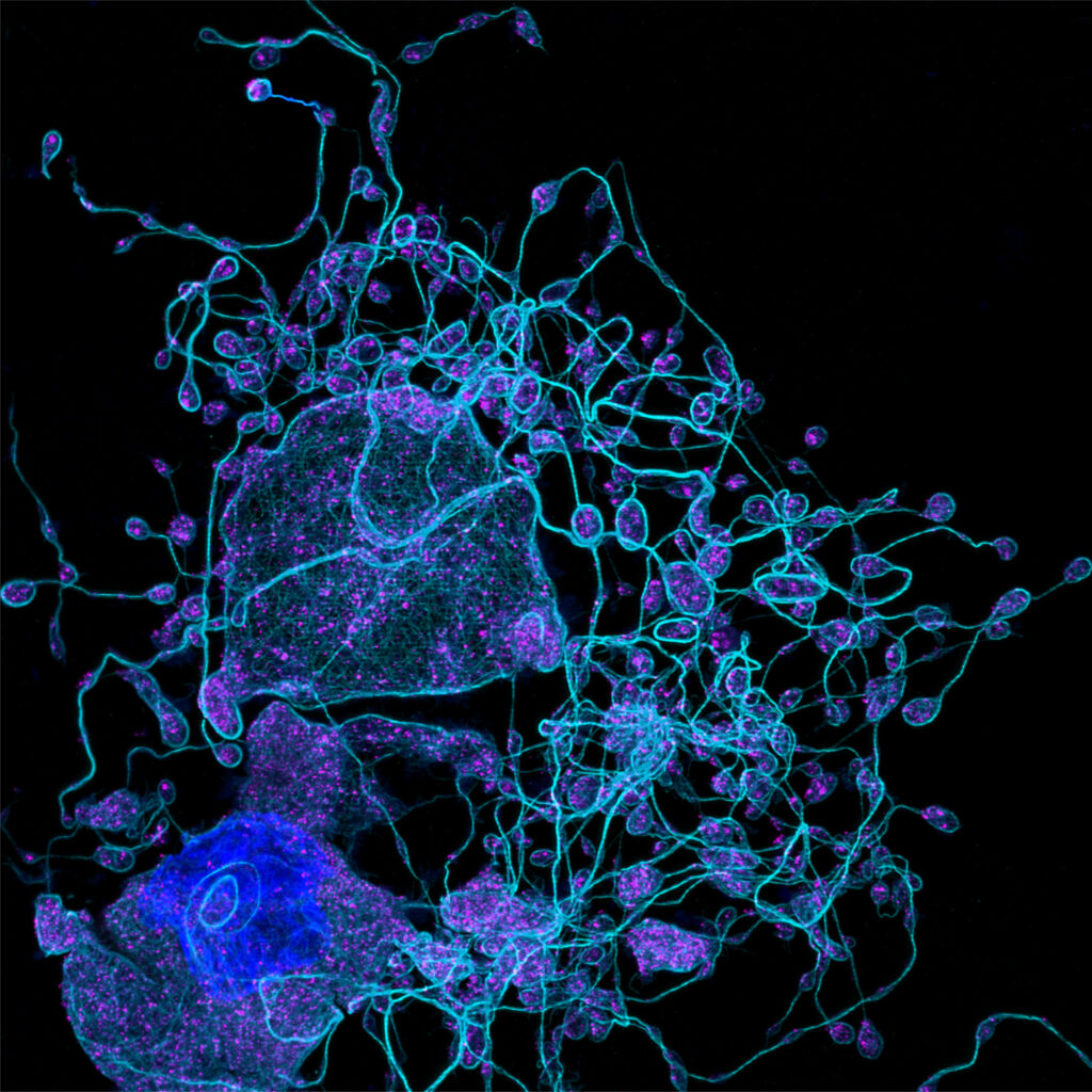 2-dimensional cultures of bone marrow megakaryocytes