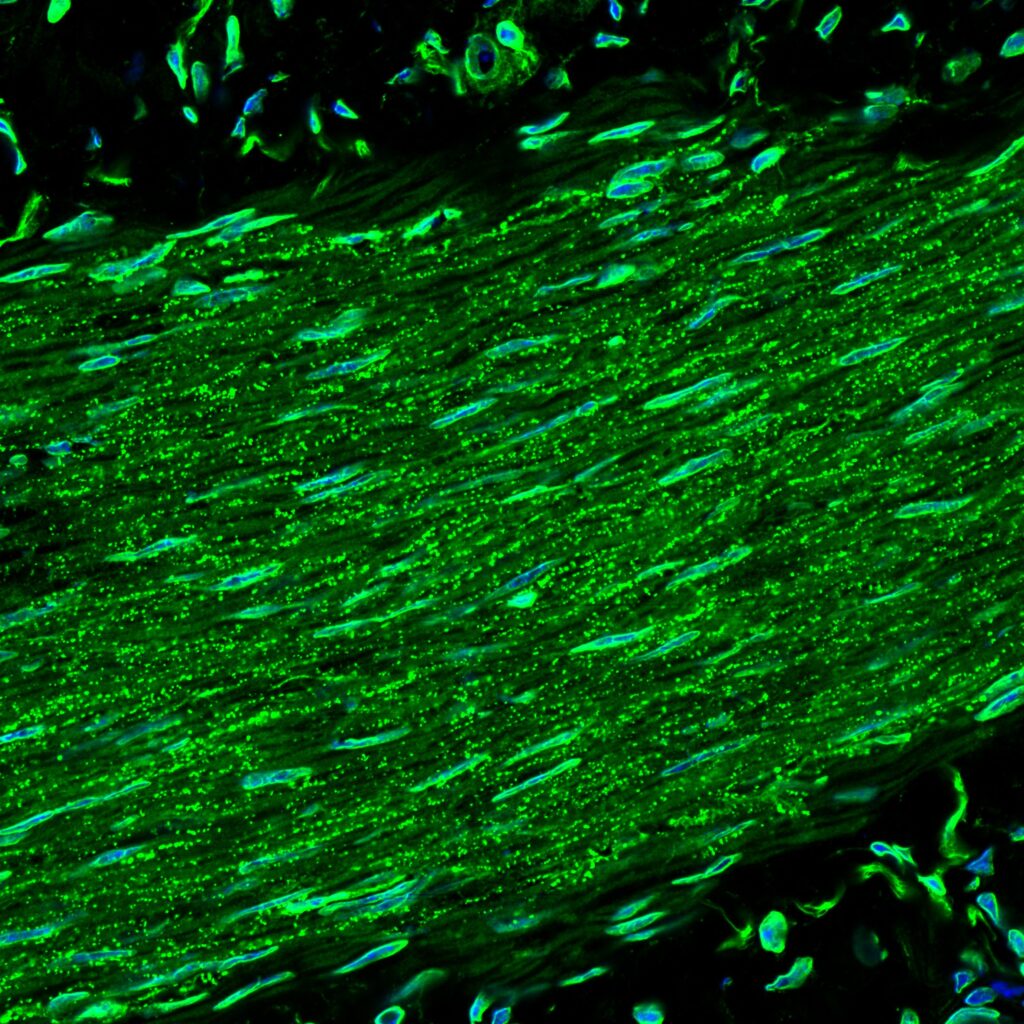 stained murine small intestinal smooth muscle for connexin 43